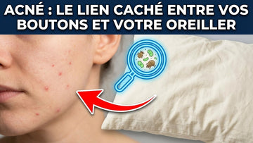Acné : Le lien caché entre vos boutons et votre oreiller